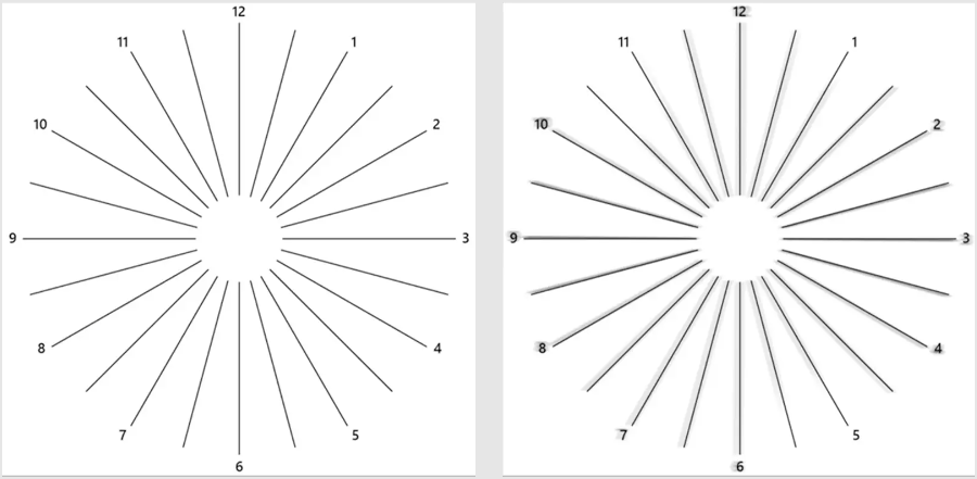 Astigmatism