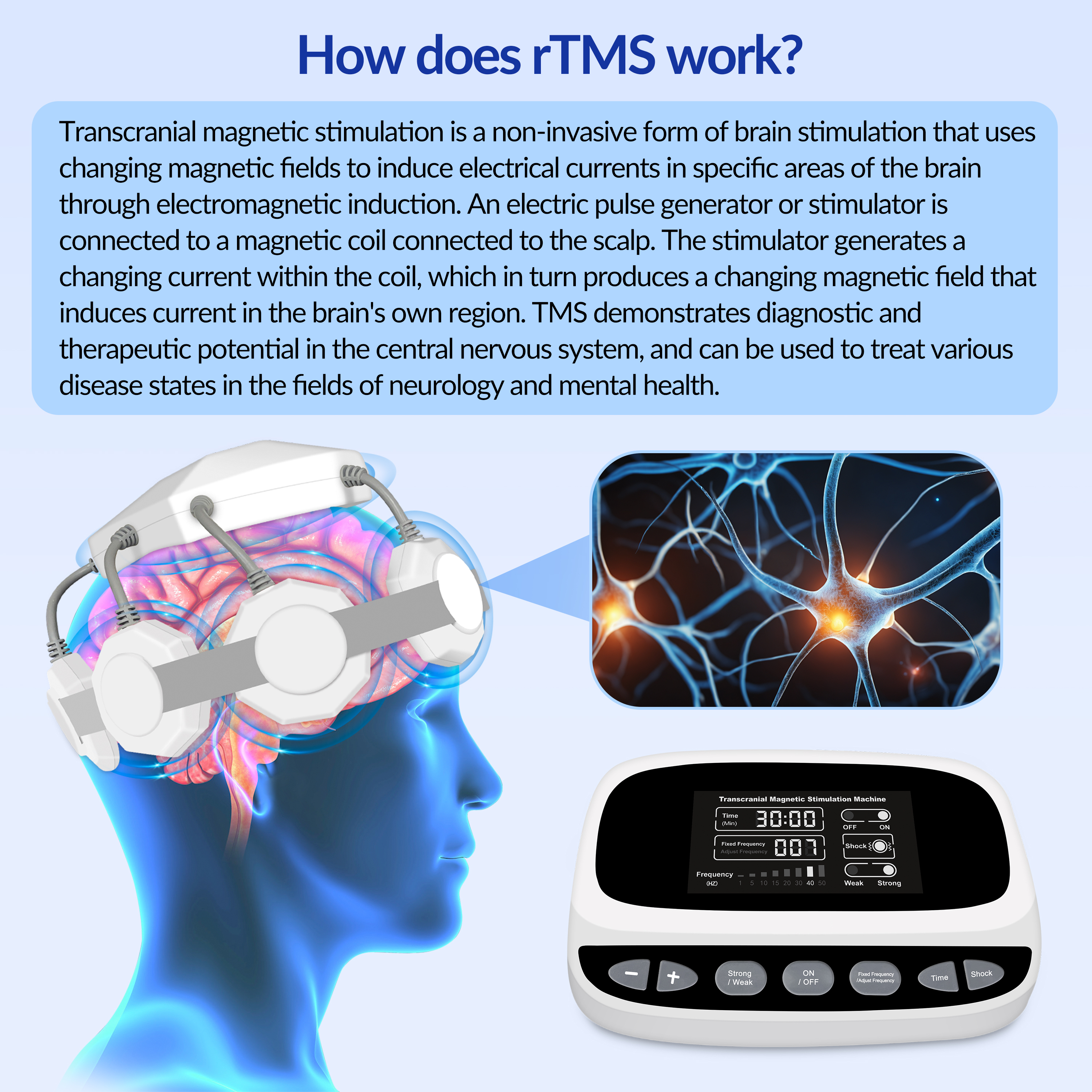 transcranial magnetic stimulation