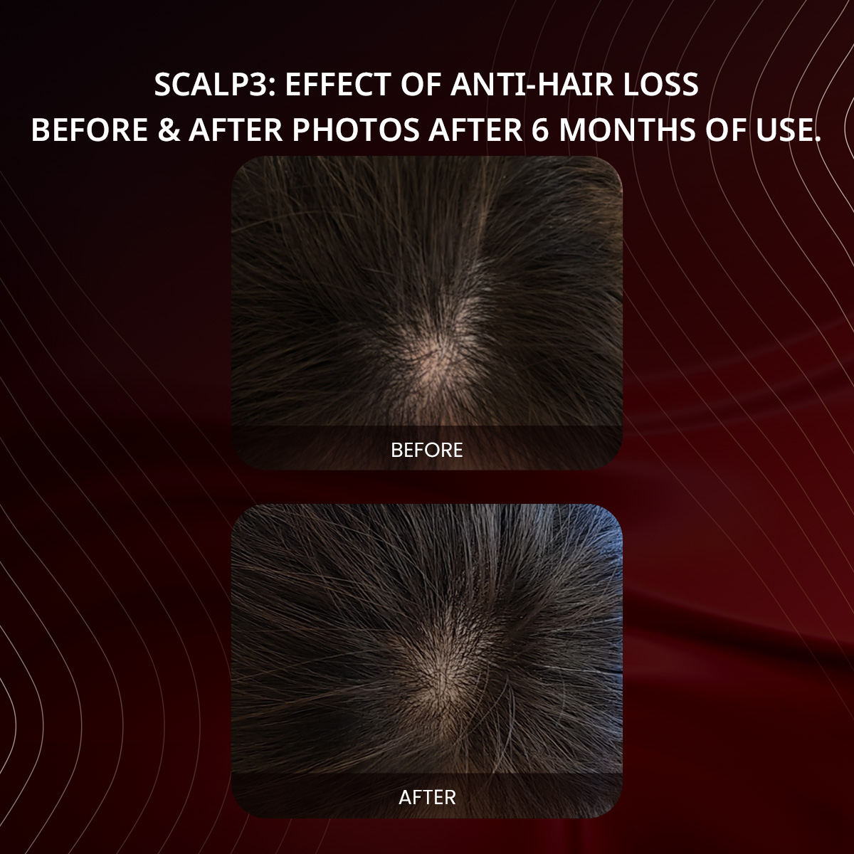 before & after