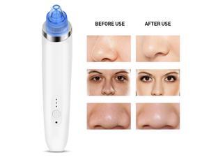 Electric Skin Cleaner Blackhead Extraction Tool, Pore Cleanser with 4 Replaceable Suction Heads For Face and Body, Women and Men (White) Electric Skin Cleaner Blackhead Extraction Tool, Pore Cleanser with 4 Replaceable Suction Heads For Face and Body, Women and Men (White)