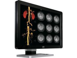 Barco Coronis Fusion MDCC-4330 30.4" LED LCD Monitor - 16:10 - 18 ms Barco Coronis Fusion MDCC-4330 30.4" LED LCD Monitor - 16:10 - 18 ms