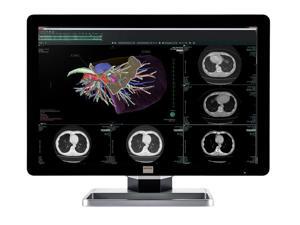 New Barco® Coronis Fusion MDCC-6430 6MP Color Medical Diagnostic Radiology LED Monitor (K9602811) New Barco® Coronis Fusion MDCC-6430 6MP Color Medical Diagnostic Radiology LED Monitor (K9602811)