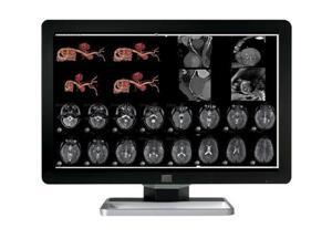 New Barco Coronis Fusion MDCC-4330 4MP LED Color Medical Diagnostic Radiology Display Monitor (K9301625A) New Barco Coronis Fusion MDCC-4330 4MP LED Color Medical Diagnostic Radiology Display Monitor (K9301625A)