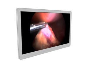 New Barco® MDSC-8255 4K UHD Color LED Surgical Display (K9307933) New Barco® MDSC-8255 4K UHD Color LED Surgical Display (K9307933)