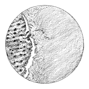 Image of tooth with Rennou