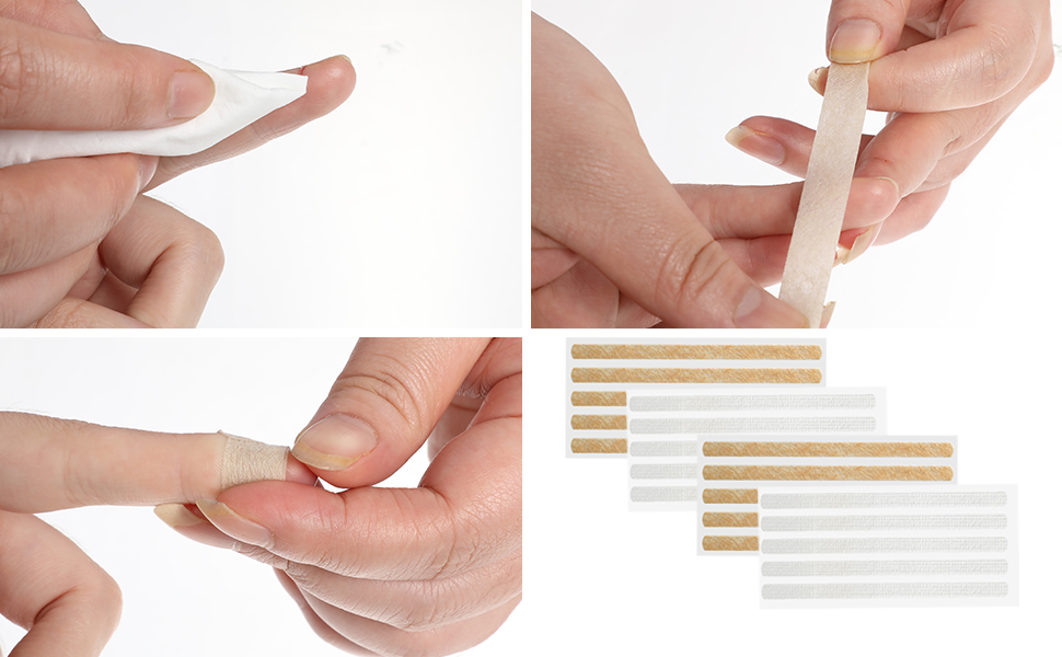 Adhesive Skin Closure