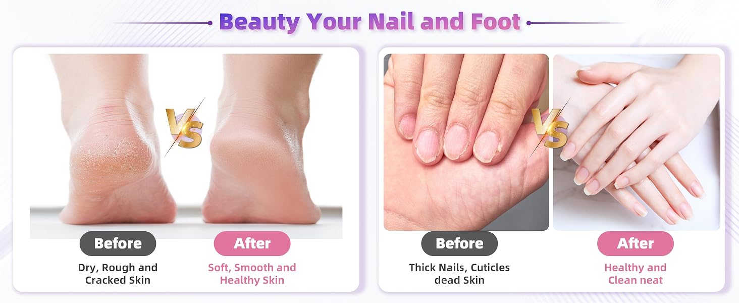 Text reads 'Beauty Your Nail and Foot'. Before/After comparison images showing treatment results for cracked, dry, and damaged skin on feet and nails.
