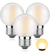 Sphoon Dimmable LED 4W Globe Light Bulb,40W Equivalent E26 Standard Screw Base Small Decorative B...