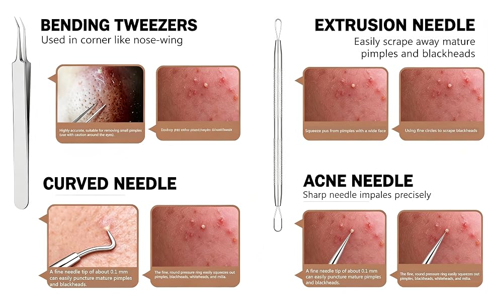 Pimple Popper Tool kit