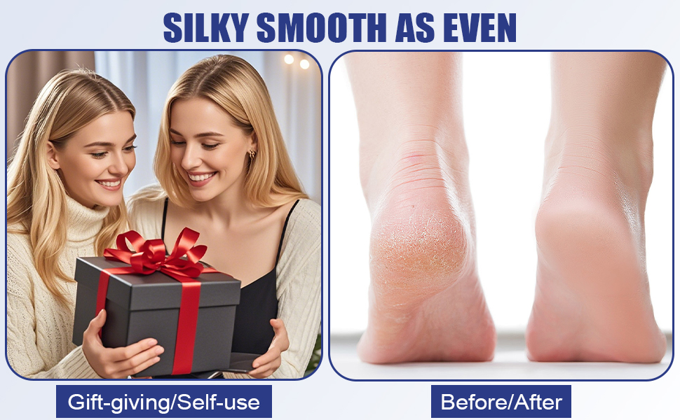 Split image: Left shows two women with a gift box. Right displays close-up of smooth, moisturized heels, suggesting a before/after comparison for a foot care product.