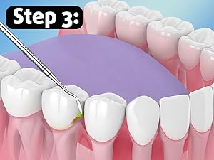 G.CATACC oral care kit with dental picks for teeth cleaning, gum dental picks, tooth cleaner