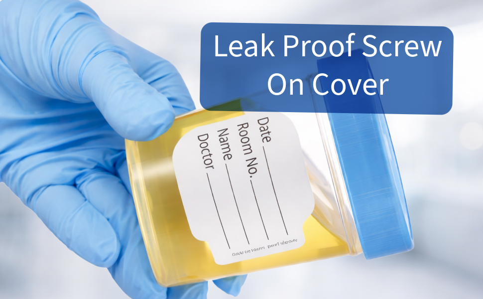 Individually wrapped sterile specimen cups designed for clean and hygienic medical sample collection