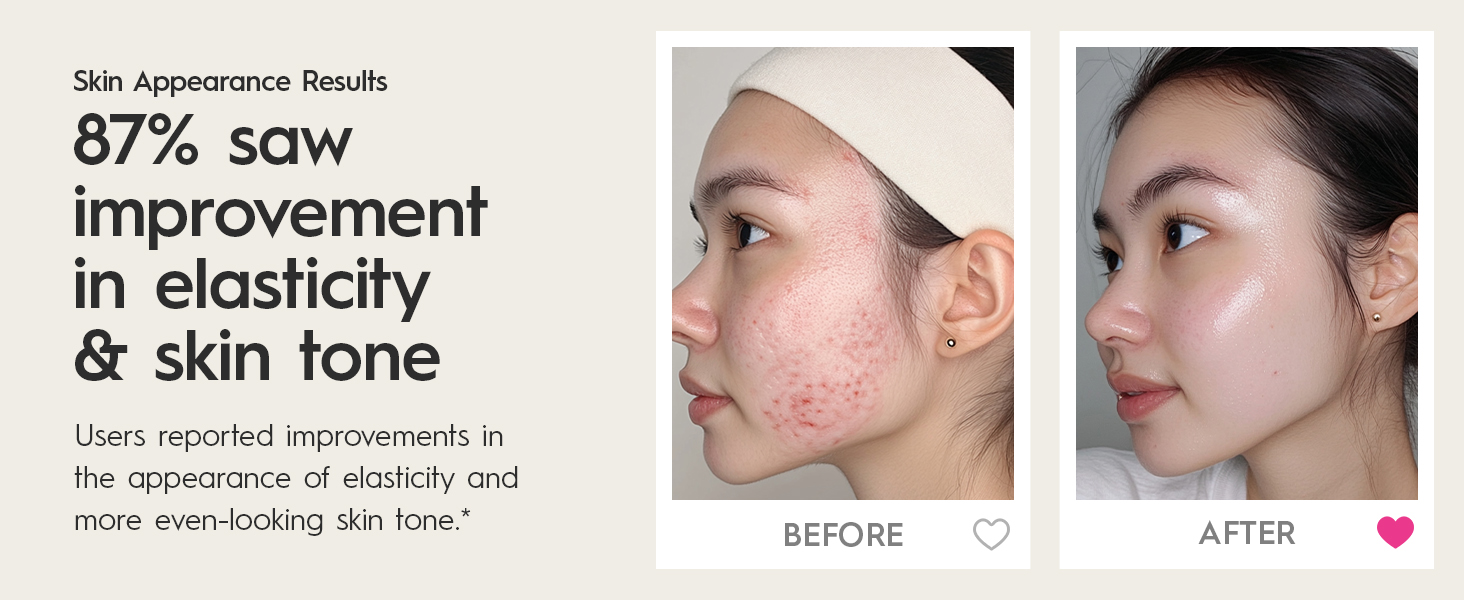 87% saw improvement in elasticity & skin tone