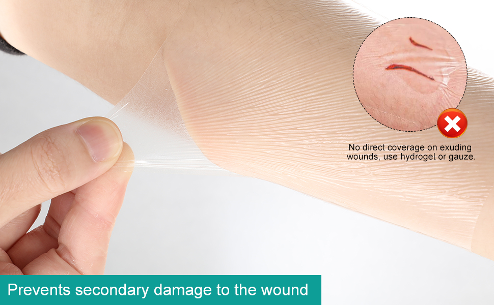 Waterproof Wound Bandage