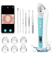 Facial Pore Blackhead Remover Vacuum, 1080P Camera Blackhead Remover, 20x Zoom, 8 LEDs & 3 Suctio...