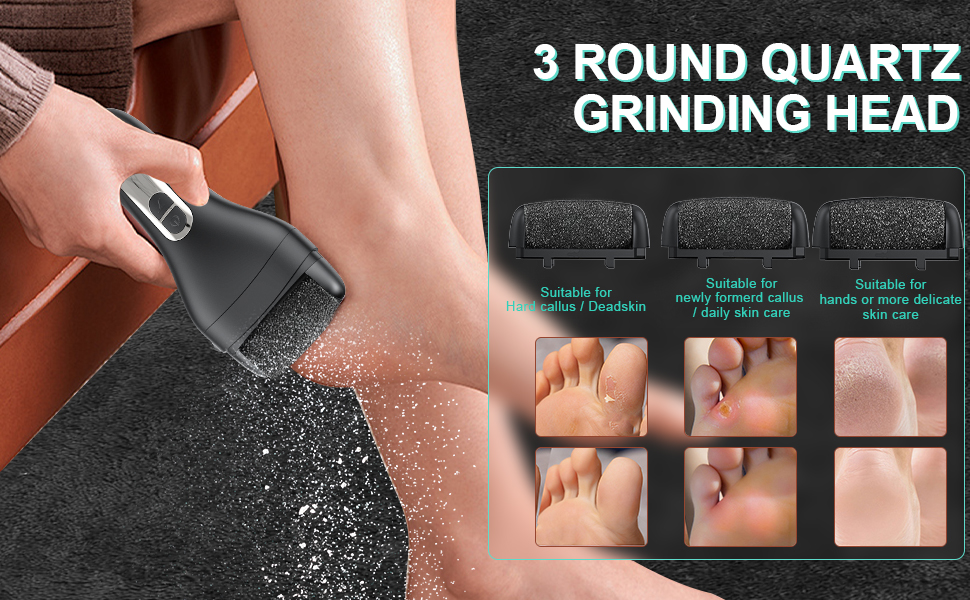 foot callus remover