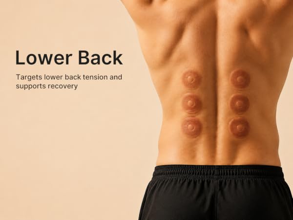 cupping therapy set
