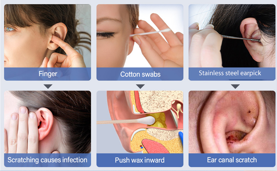 ear wax removal tool camera ear camera earwax cleaner cleaning Otoscope Ear Scoop Earwax removal kit