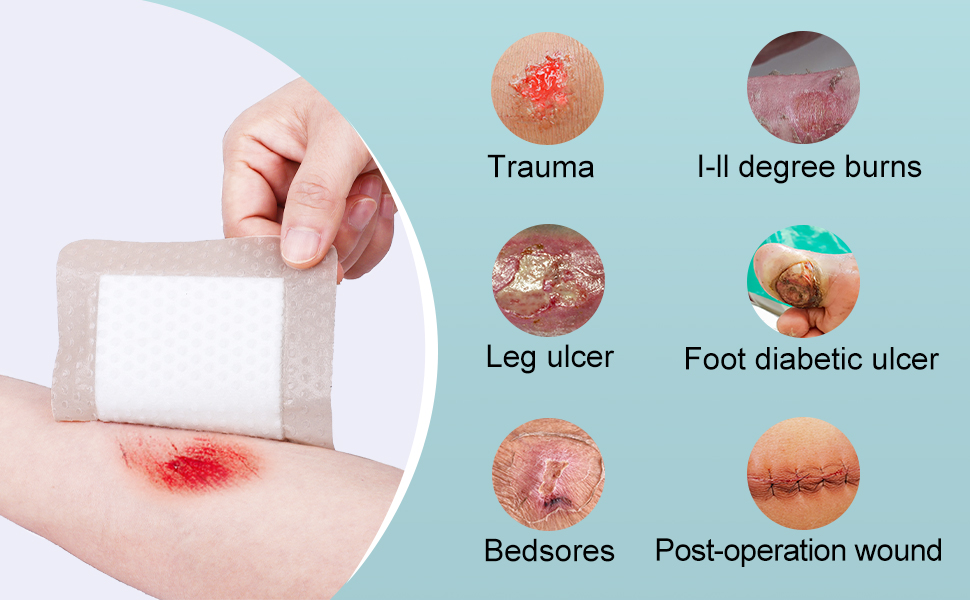 Silicone Foam Dressing