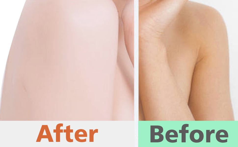 improve skin