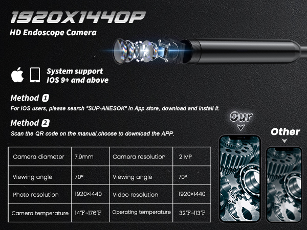 endoscope