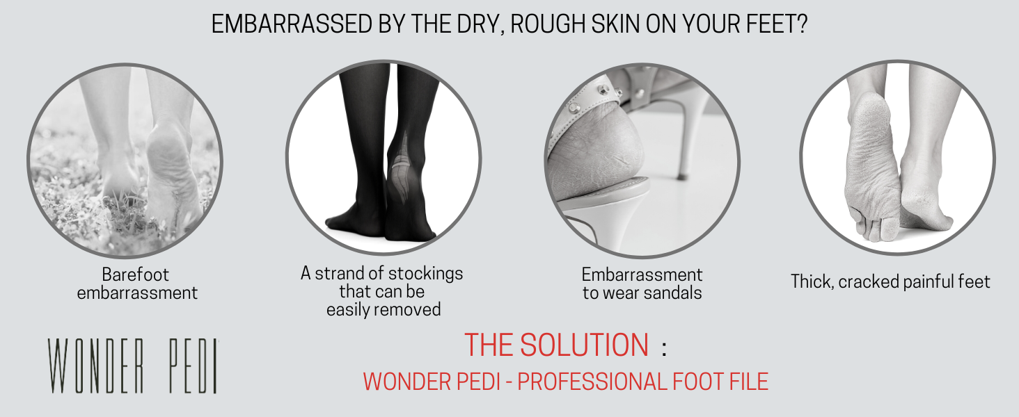 EMBARRASSED BY THE DRY, ROUGH SKIN ON YOUR FEET