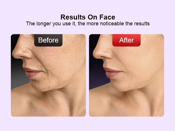 skincare machine