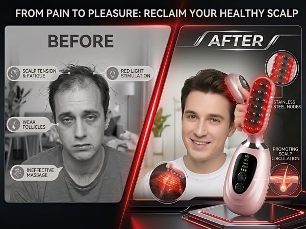 Facial Massager