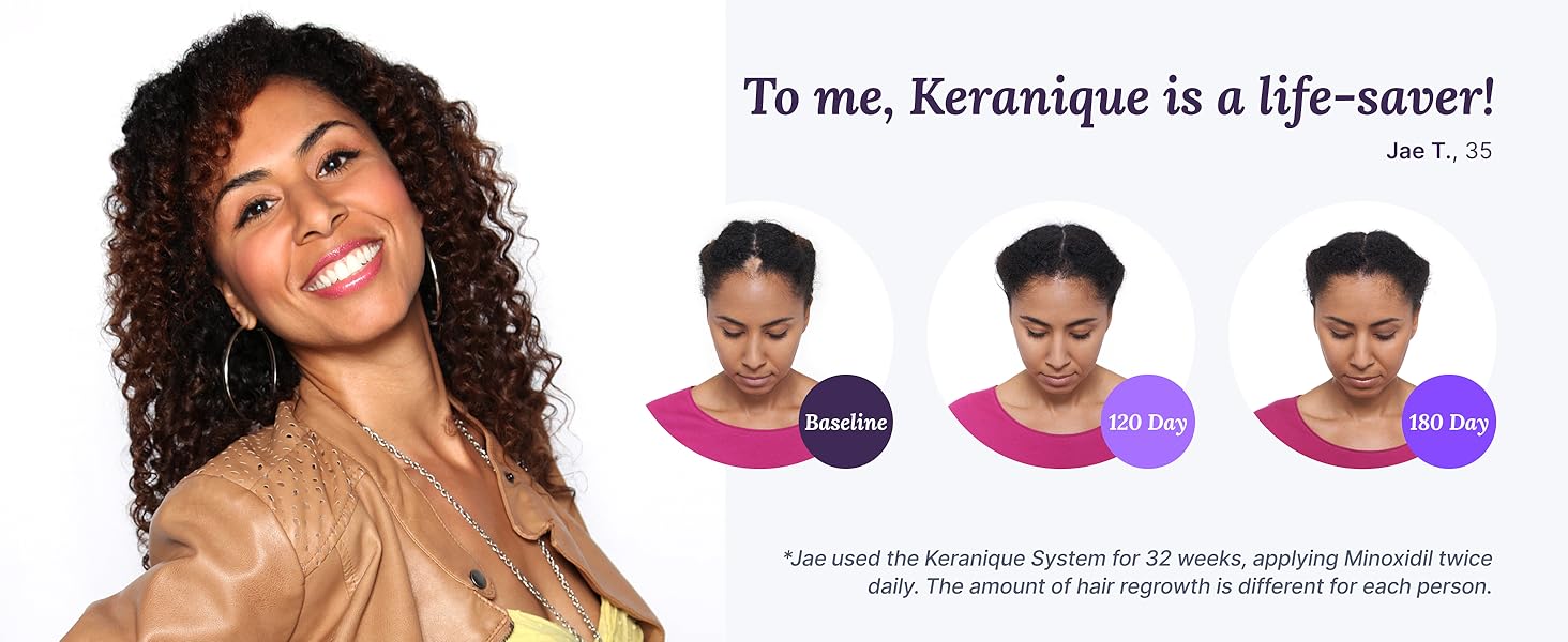 Keranique Scalp Massager Silicone Head Scrubber Hair Growth Stimulator Shower Massage Stress Relax.