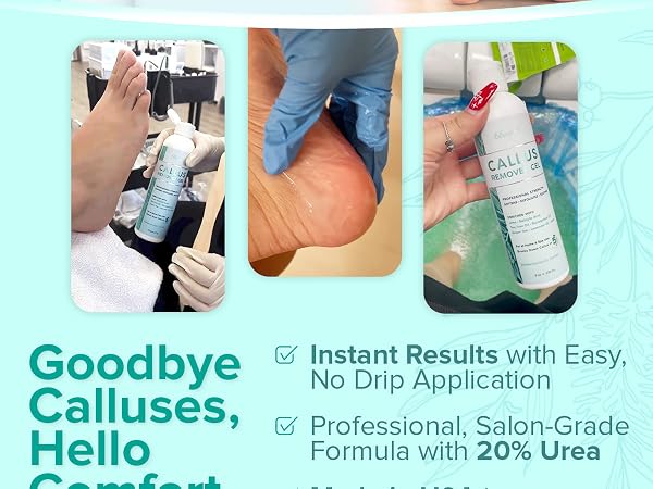 Ebanel Callus remover gel easy application professional grade formula with 20% urea made in USA