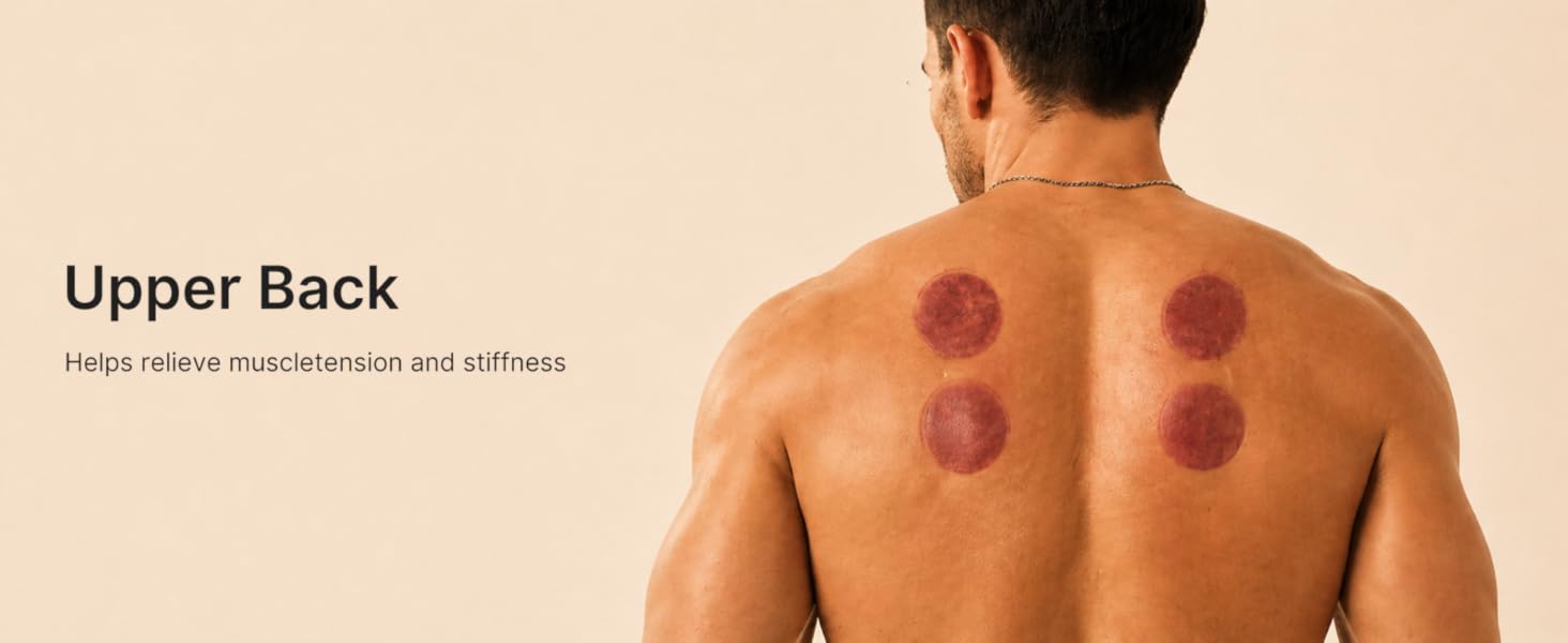 cupping kit for massage therapy