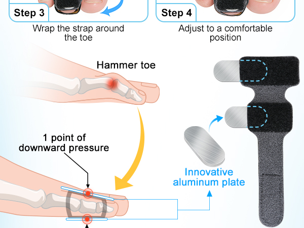Adjustable Hammer Toe Corrector