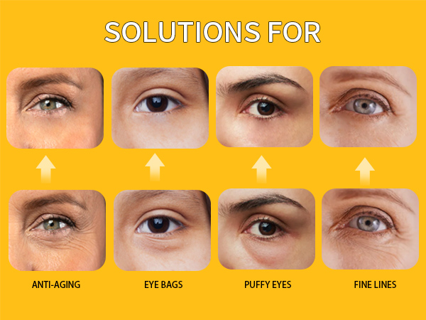 Eye Bags Treatment Eye Mask Skincare Under Eye Gel Pads anti wrinkle hydrogel eye patches