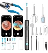 BEBIRD R1 Ultra Ear Wax Removal Tweezers: 1296P HD Ear Camera Cleaner IP67 | FSA/HSA Painless Twe...