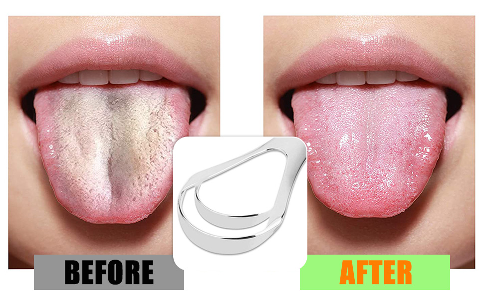 tongue scraper with case