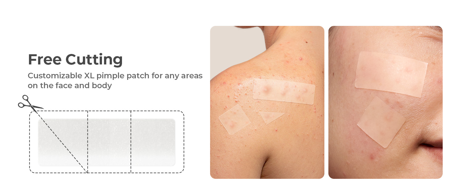 TKTK acne patches