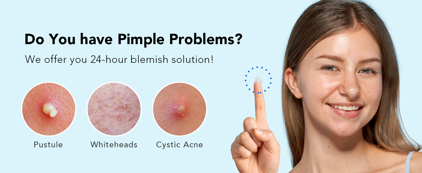acne patches for face