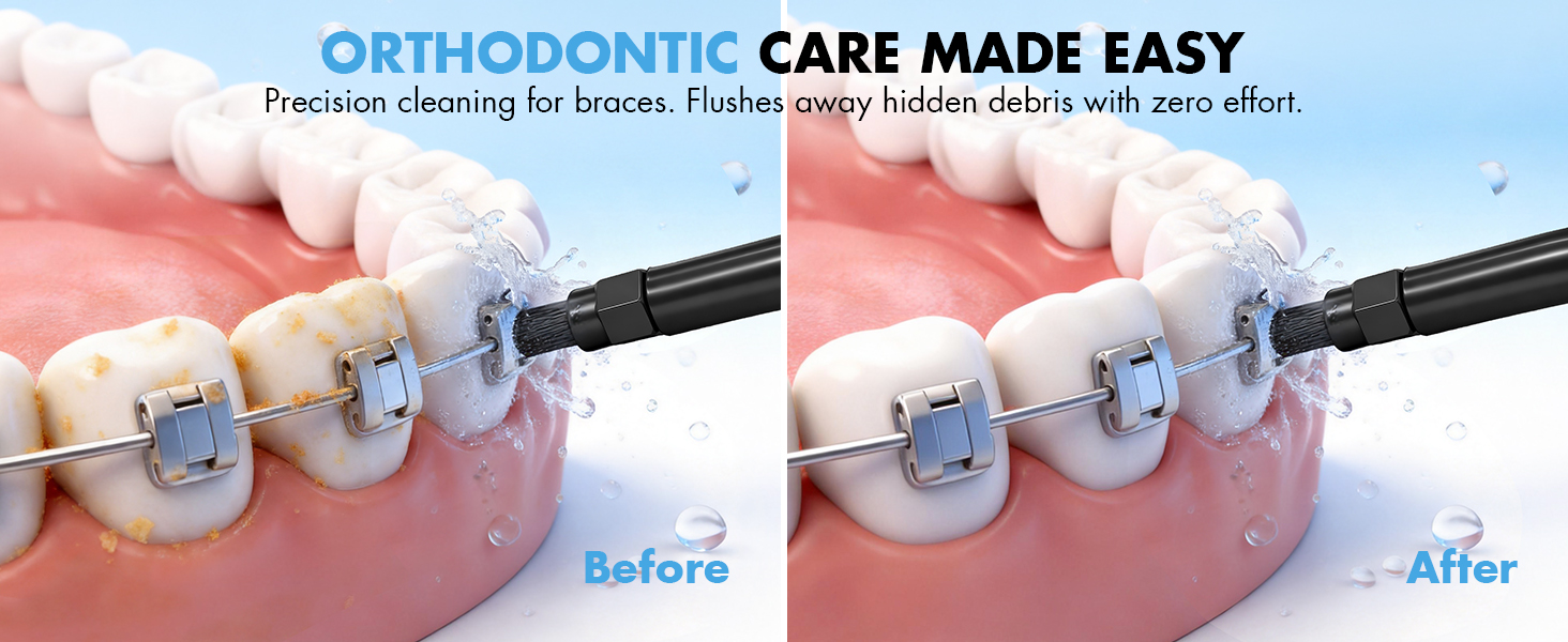 water flosser for braces