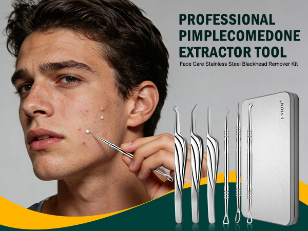 Blackhead and Acne Extractor Kit