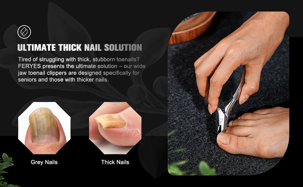 ingrown toenail tool