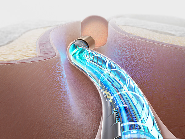 bebird ear wax removal tool with camera and light for family