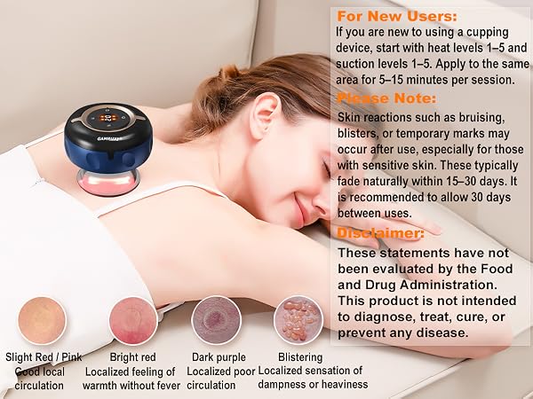 cupping set