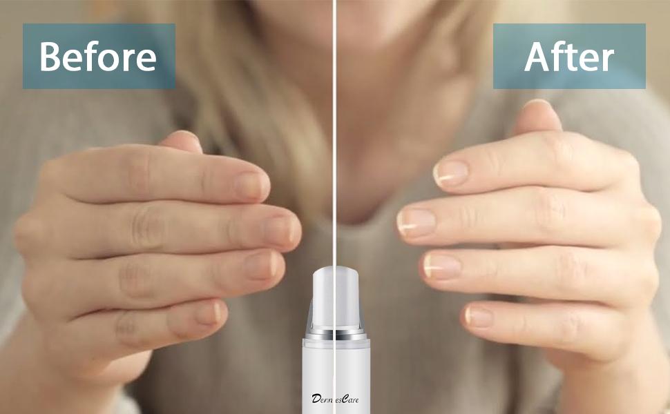 the difference before and after using DenniesCare electric nail buffer
