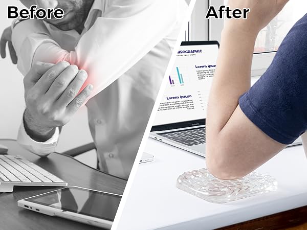 Ergonomic Keyboard Elbow Rest Pad
