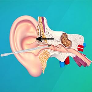 ear cleaner