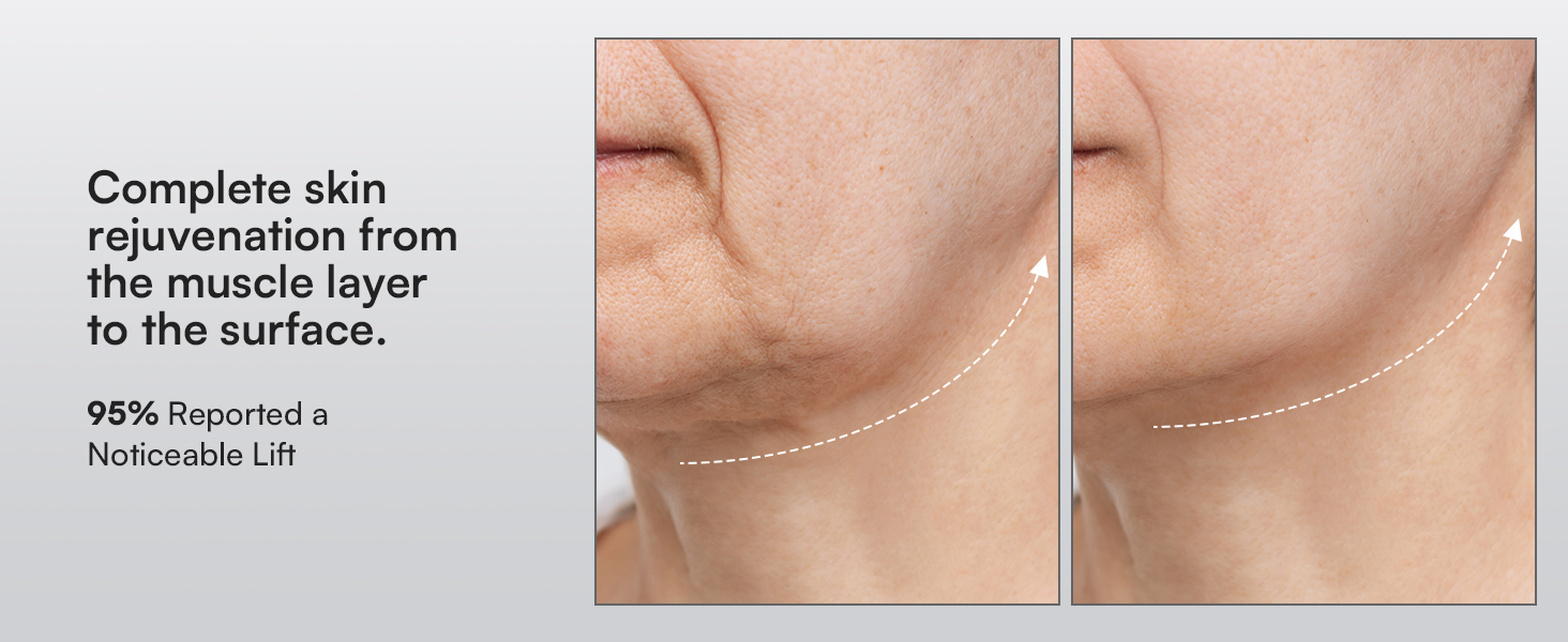 Red Light Therapy for Face