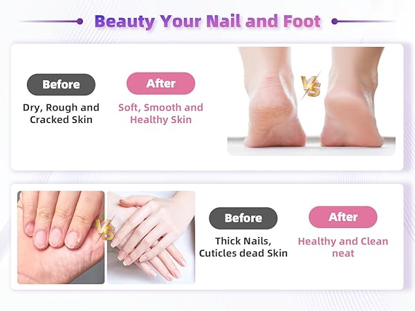 Text reads 'Beauty Your Nail and Foot'. Before/After comparison images showing feet and nail care results with 'Before' and 'After' labels.