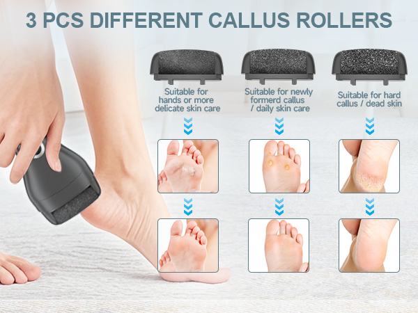 3 PCS Different Callus Rollers