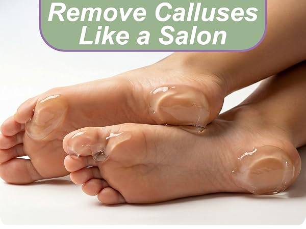 callus remover kit