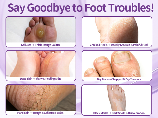 foot mask
